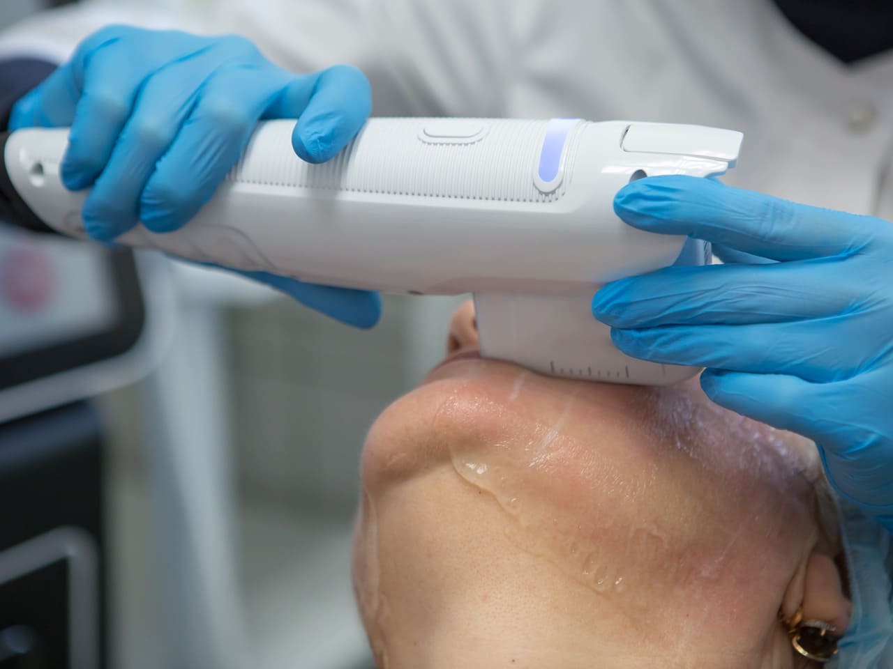 How a Non Surgical Facelift Works