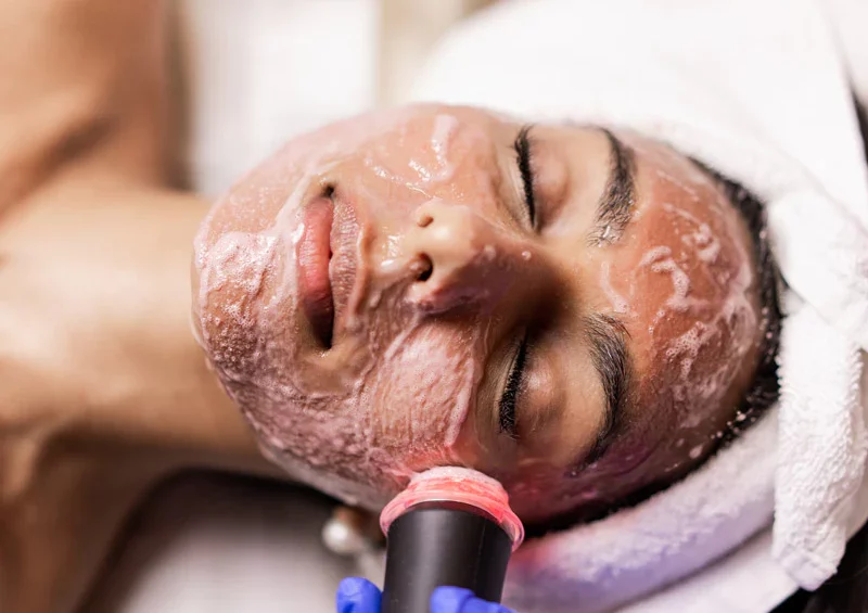 How an Oxygen Facial Works