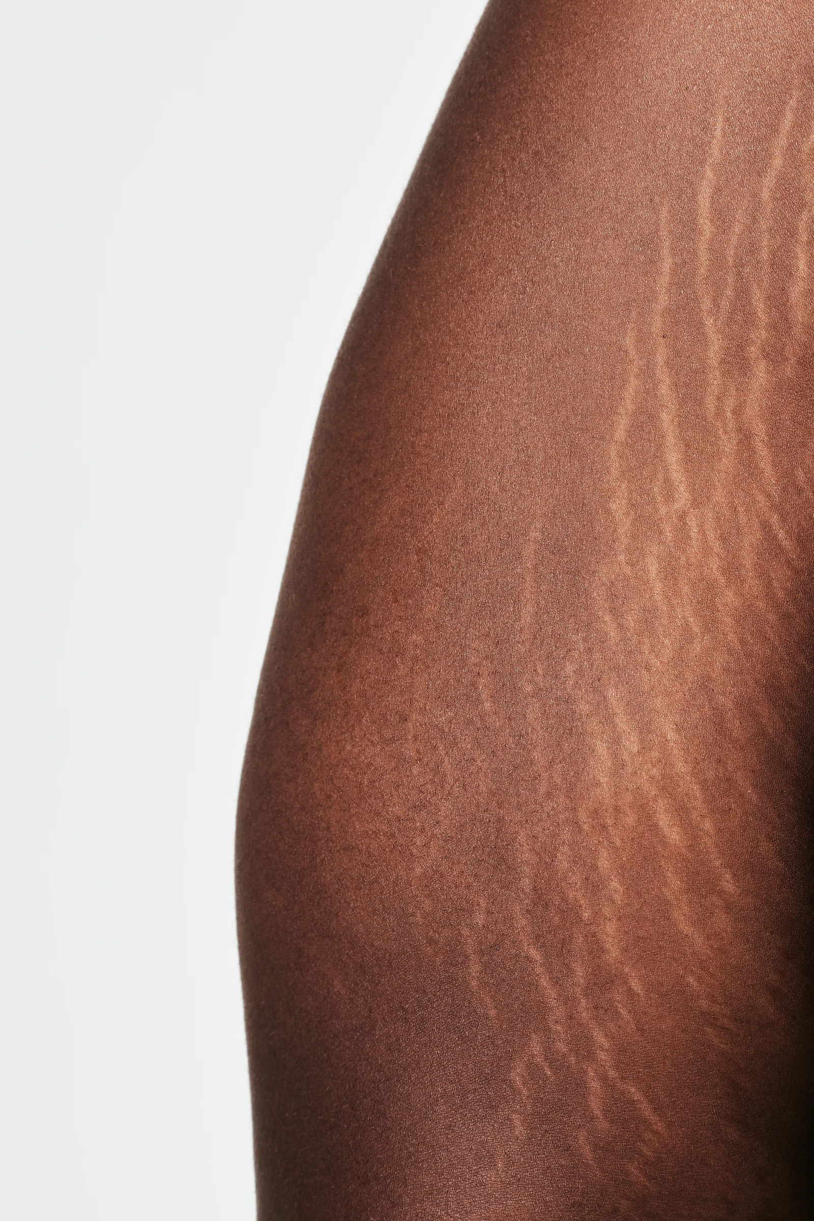 How Stretch Marks Reduction Works